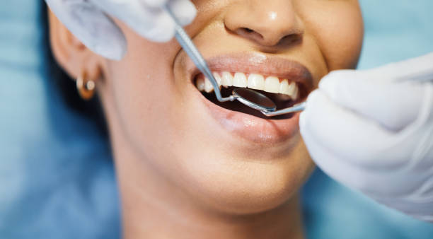 Best Emergency Denture Repair in Vernon, AL